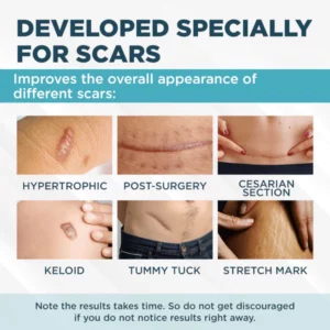 ClearScar™ Advanced Scar Reduction Gel