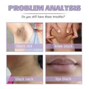 Collagen Acanthosis Nigricans Therapy Cream