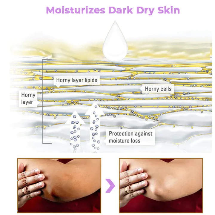 Collagen Acanthosis Nigricans Therapy Cream