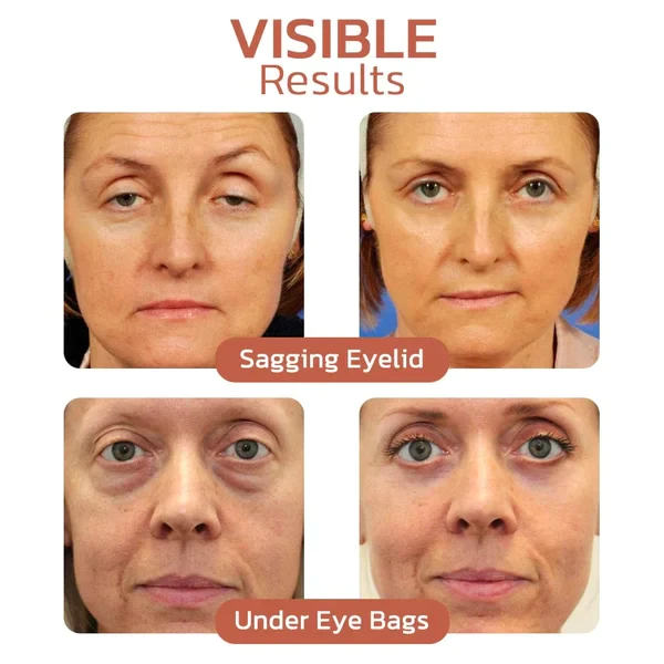 Crocodile Oil Healing & Repairing Eye Cream