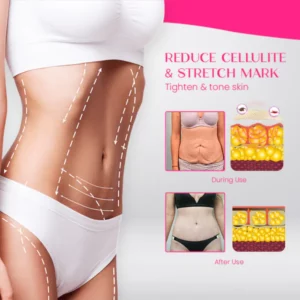 CurvyFit™ Belly Slimming Patch
