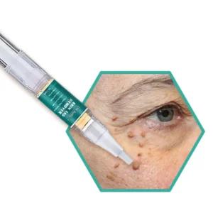 Alternative view of DR. Reilly™ Skin Tag Remover