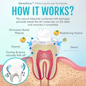 DentalCare™ Whitening Mousse Toothpaste