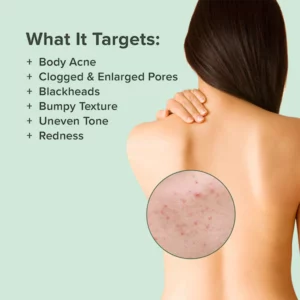 EELHOE™ Back Acne Treatment Spray