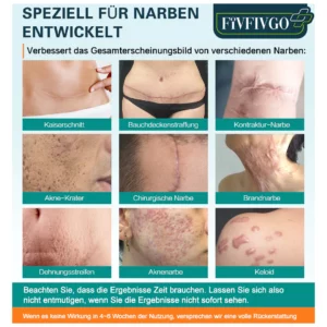 Fivfivgo™ Advanced Narbenentfernungsspray
