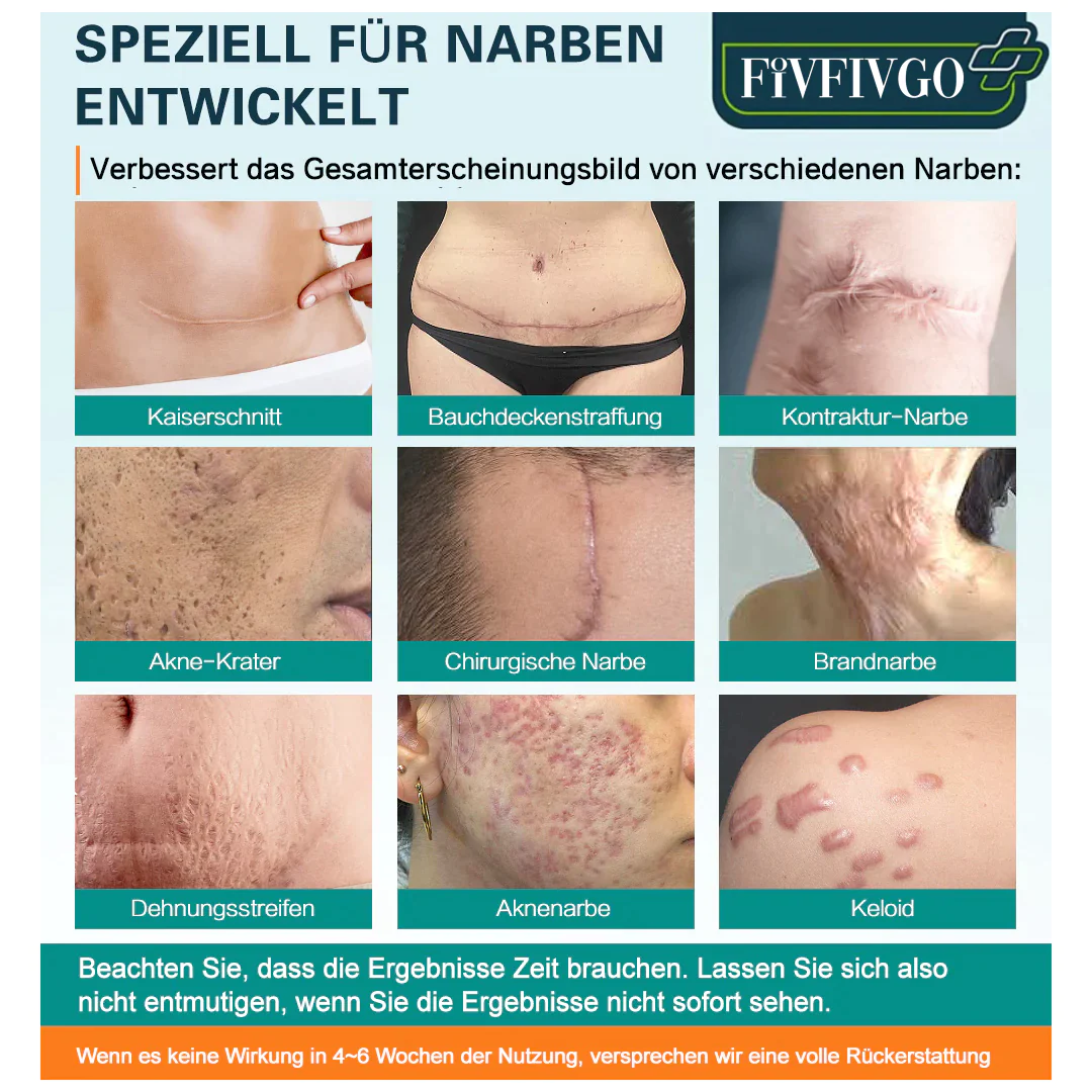 Fivfivgo™ Advanced Narbenentfernungsspray