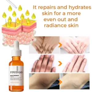 Fivfivgo™ Advanced Skin Brightening Serum zur Entfernung von Melanose und dunklen Flecken