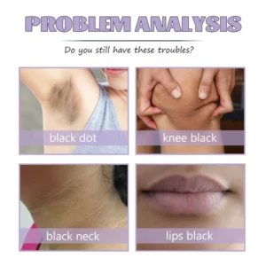 Fivfivgo™ Collagen Acanthosis Nigricans Therapiecreme
