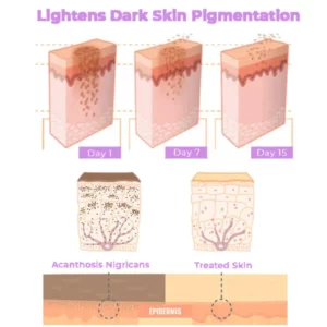 Fivfivgo™ Collagen Acanthosis Nigricans Therapiecreme