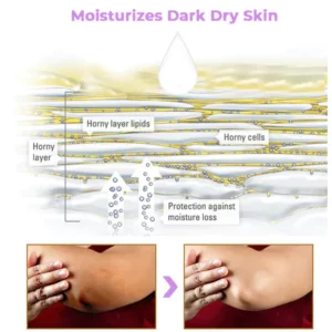 Fivfivgo™ Collagen Acanthosis Nigricans Therapiecreme