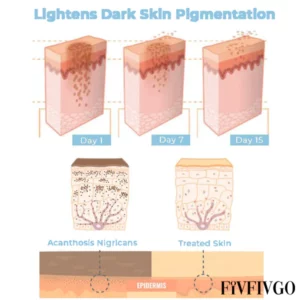 Fivfivgo™ Collagen Boost Acanthosis Nigricans Therapy Cream