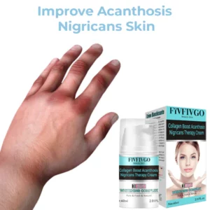 Fivfivgo™ Collagen Boost Acanthosis Nigricans Therapy Cream