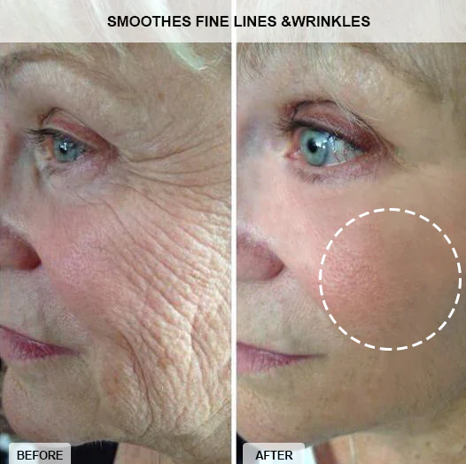 Fivfivgo™ Collagen-Boost Lift Anti-Aging Cream