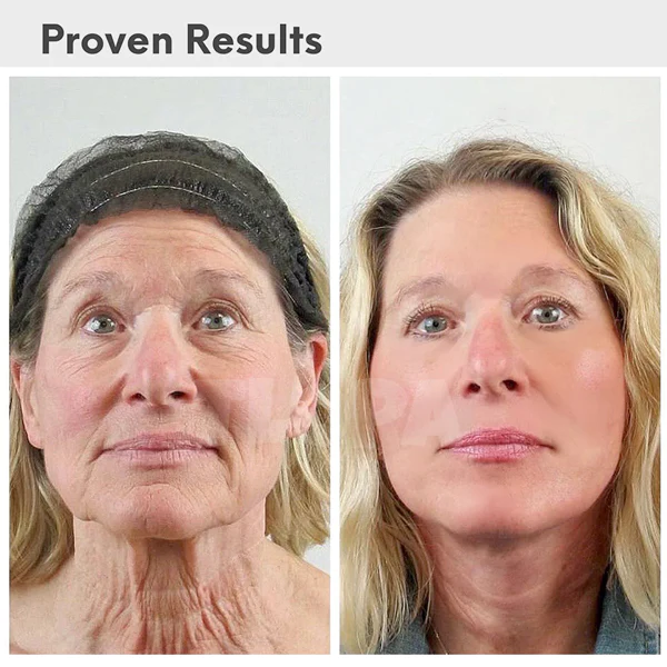 Fivfivgo™ Luxury Collegan Boost Hyaluronic Acid Anti-Aging Serum