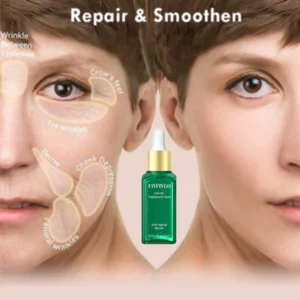 Fivfivgo™ Luxus-Hyaluronsäure-Anti-Aging-Serum