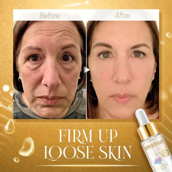 Fivfivgo™ SkinRevive Kollagen-Booster-Serum