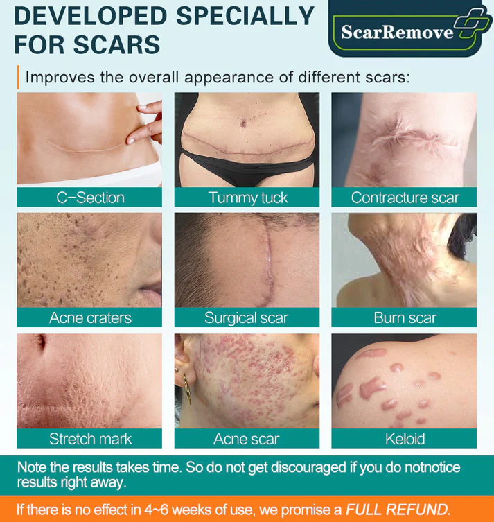 Flashing™ Advanced Scar Spray For All Types of Scars - Image 6