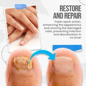FungusShield Nail Fungus Treatment Cream