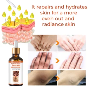 GFOUKTM Acanthosis Nigricans Therapy Oil