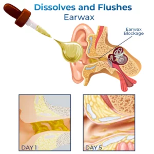 GFOUK™ Cochlea-Pflegeöl