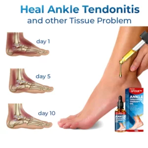 GFOUK™ German Ankle Tendonitis Therapieöl