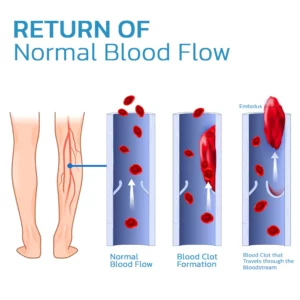 GFOUK™ TitanVein Far Infrared Tourmaline Acupressure Insoles