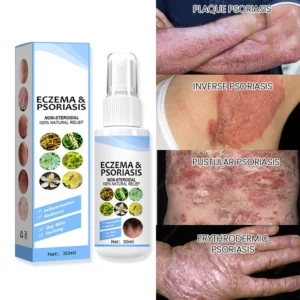 Herbal Psoriasis Relief Spray