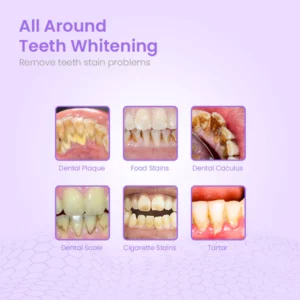 HerbalBrite™ Teeth Whitening Mousse