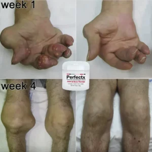 He™ Perfectx Joint And Bone Therapy Cream