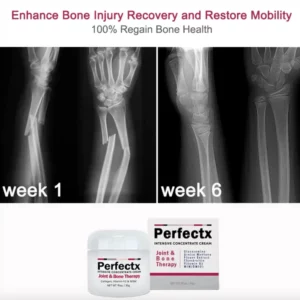 He™ Perfectx Joint And Bone Therapy Cream