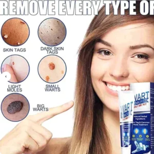 Instant Warts Removal Cream™