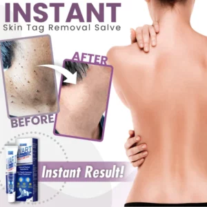 Instant Warts Removal Cream™