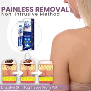 Instant Warts Removal Cream™