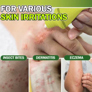 Intensive Eczema Relief Cream