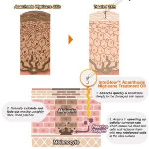 IntoGlow™ Acanthosis Nigricans Treatment Oil