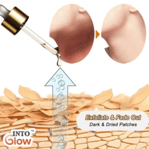 IntoGlow™ Acanthosis Nigricans Treatment Oil