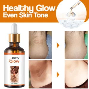 IntoGlow™ Acanthosis Nigricans Treatment Oil