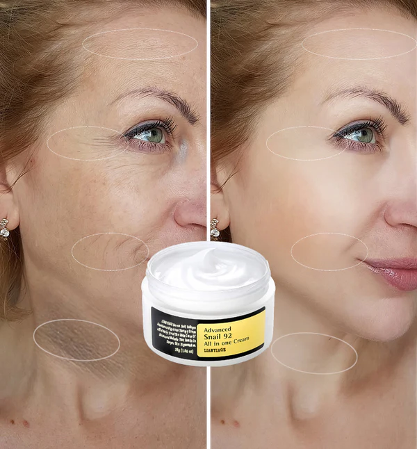 LIANTIAGE® Korean Snail Collagen Acanthosis Nigricans Therapy Cream - Image 4
