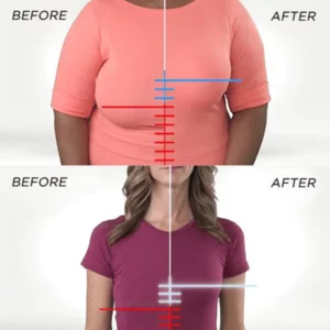 Lymphatic Detox Shaping & Breast Firming & Lifting Posture Corrector Bra