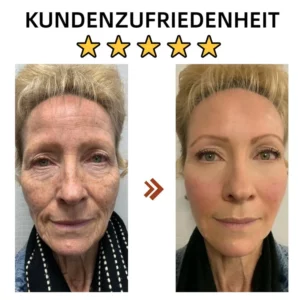 Mejor vendido ReSkin™ Advanced Deep Anti-Falten Serum