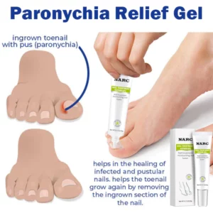 Alternative view of NARC™ Removal Paronychia Gel