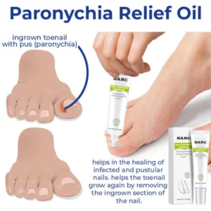 NARC™ Removal Paronychia Oil