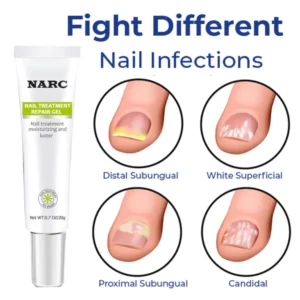 NARC™ Removal Paronychia Oil