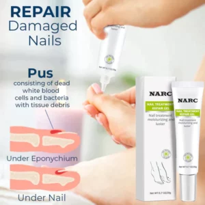 NARC™ Removal Paronychia Oil