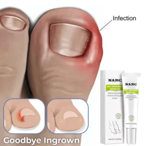 NARC™ Removal Paronychia Oil