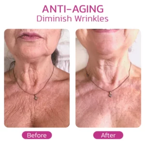 NECKPON Hydrolized Collagen Neck Cream