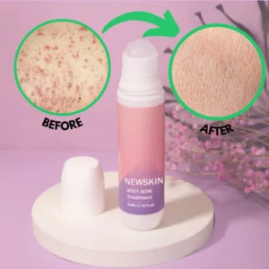 NEWSKIN™ Pimple & Acne Treatment Roll On Serum