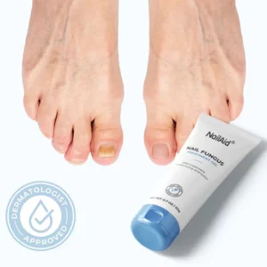 NailAid™ Nail Fungus Treatment Gel