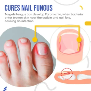 NailSpeed™ Light Cure Fungal Nail Pen