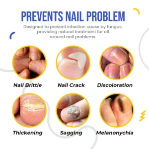 NailSpeed™ Light Cure Fungal Nail Pen